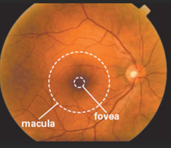 Age-related macular degeneration